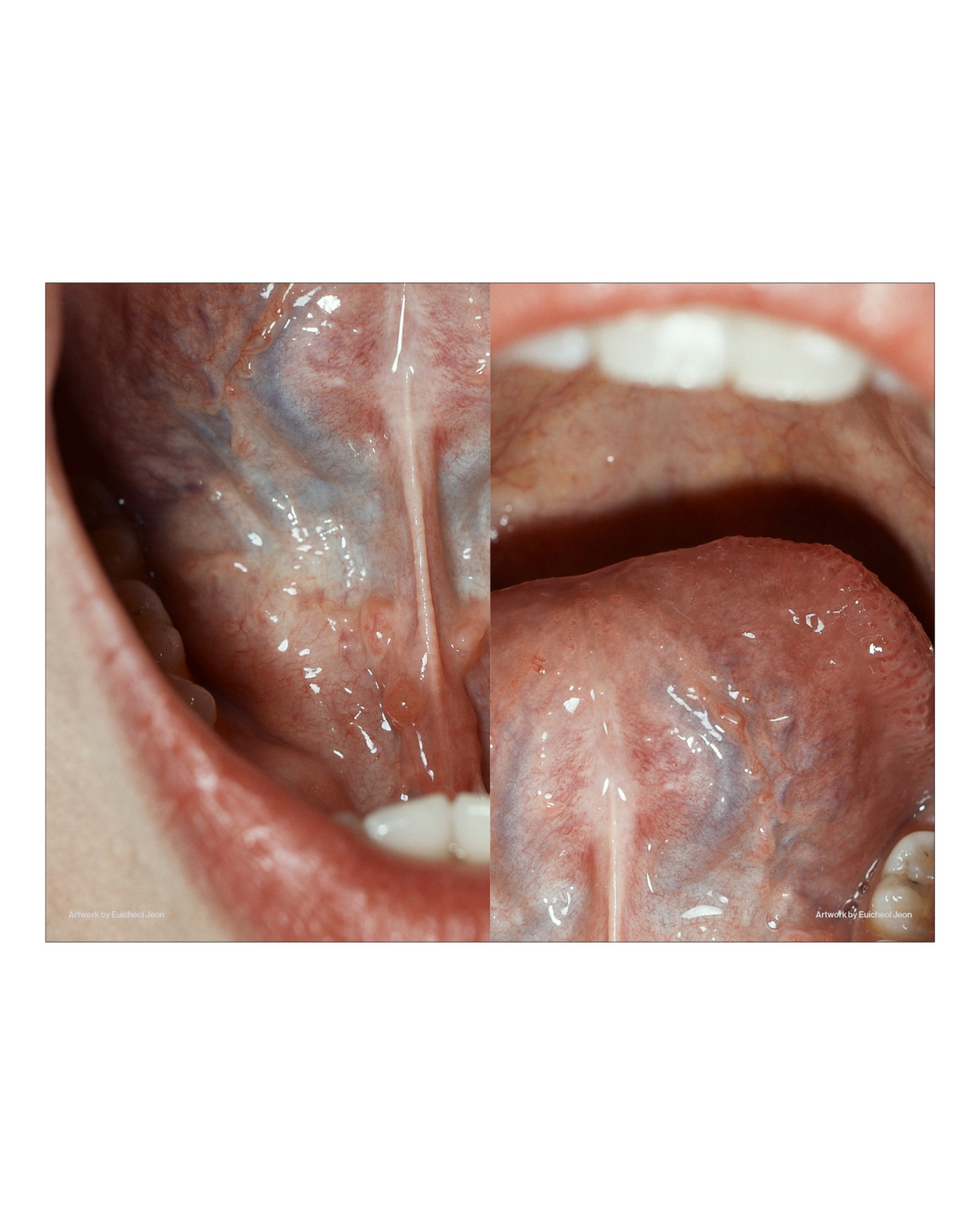 Subverted Anatomical Landscape ≪KILL≫ - 28