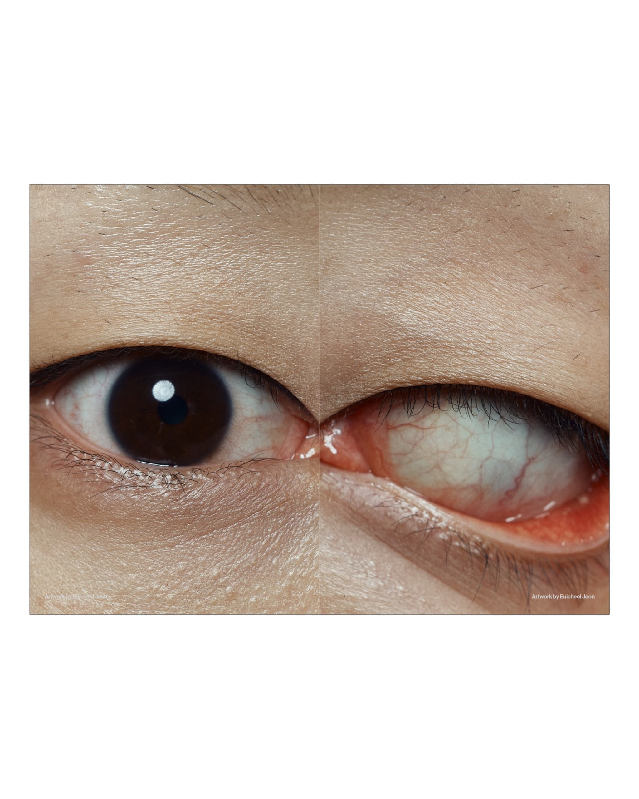 Subverted Anatomical Landscape ≪KILL≫ - 35